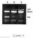 Fig. 05 - Method for the detection of schizophrenia related gene transcripts in blood