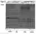 Fig. 14 - Method for the detection of schizophrenia related gene transcripts in blood