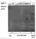 Fig. 21 - Method for the detection of schizophrenia related gene transcripts in blood
