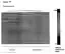 Fig. 26 - Method for the detection of schizophrenia related gene transcripts in blood