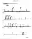 Fig. 97 - Detection of genetic polymorphisms