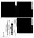 Fig. 23 - Compositions and methods for the treatment of cancer
