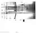 Fig. 08 - Method for detection of a target nucleic acid with a FEN nuclease
