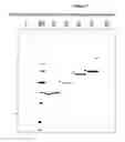 Fig. 10 - Cell lysis composition, methods of use, apparatus, and kit