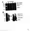 Fig. 02 - Non-invasive enzyme screen for tissue remodeling associated conditions