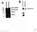 Fig. 03 - Non-invasive enzyme screen for tissue remodeling associated conditions