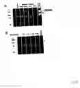 Fig. 05 - Non-invasive enzyme screen for tissue remodeling associated conditions