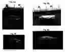 Fig. 09 - In vitro growth of tissues suitable to the formation of bone and bone forming tissue formed thereby