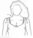 Fig. 01 - Decorative straps for a bra and a bra incorporating the same
