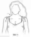Fig. 02 - Decorative straps for a bra and a bra incorporating the same