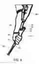 Fig. 03 - Prosthetic device for golfing