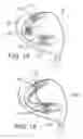 Fig. 07 - Golf club head having movable weights