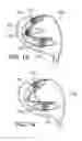 Fig. 07 - Golf club head having movable weights