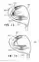 Fig. 07 - Golf club head having movable weights