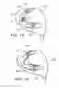 Fig. 07 - Golf club head having movable weights