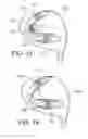 Fig. 07 - Golf club head having movable weights