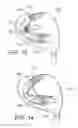Fig. 07 - Golf club head having movable weights