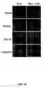 Fig. 04 - Methods for treating rheumatoid arthritis using a CTLA-4 fusion protein