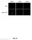 Fig. 05 - Methods for treating rheumatoid arthritis using a CTLA-4 fusion protein