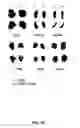 Fig. 06 - Methods for treating rheumatoid arthritis using a CTLA-4 fusion protein