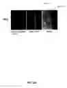 Fig. 07 - Methods for treating rheumatoid arthritis using a CTLA-4 fusion protein