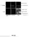 Fig. 09 - Methods for treating rheumatoid arthritis using a CTLA-4 fusion protein