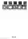 Fig. 23 - Methods for treating rheumatoid arthritis using a CTLA-4 fusion protein