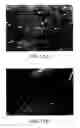 Fig. 22 - Biocompatible poly-beta-1-4-N-acetylglucosamine