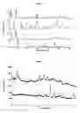 Fig. 04 - Oral administration of N-(2-chloro-6-methylphenyl)-2-[[6-[4-(2-hydroxyethyl)-1-piperazinyl]-2-methyl-4-pyrimidinyl]amino]-1,3-thiazole-5-carboxamide and salts thereof