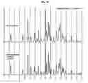 Fig. 19 - Oral administration of N-(2-chloro-6-methylphenyl)-2-[[6-[4-(2-hydroxyethyl)-1-piperazinyl]-2-methyl-4-pyrimidinyl]amino]-1,3-thiazole-5-carboxamide and salts thereof
