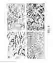 Fig. 07 - Methods for achieving a protective ACE2 expression level to treat kidney disease and hypertension