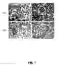 Fig. 08 - Methods for achieving a protective ACE2 expression level to treat kidney disease and hypertension
