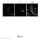 Fig. 10 - Methods for achieving a protective ACE2 expression level to treat kidney disease and hypertension
