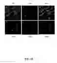 Fig. 11 - Methods for achieving a protective ACE2 expression level to treat kidney disease and hypertension