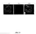 Fig. 12 - Methods for achieving a protective ACE2 expression level to treat kidney disease and hypertension
