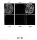 Fig. 13 - Methods for achieving a protective ACE2 expression level to treat kidney disease and hypertension