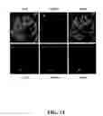 Fig. 14 - Methods for achieving a protective ACE2 expression level to treat kidney disease and hypertension
