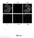 Fig. 15 - Methods for achieving a protective ACE2 expression level to treat kidney disease and hypertension