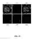 Fig. 16 - Methods for achieving a protective ACE2 expression level to treat kidney disease and hypertension