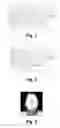 Fig. 02 - Kneadable Hand Putty as a Delivery System for Skin Conditioning and/or Thermal Therapy Agents