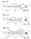 Fig. 06 - Brachytherapy apparatus and methods for using them