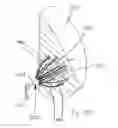 Fig. 34 - Brachytherapy apparatus and methods for using them