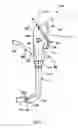 Fig. 02 - Intubation assistance apparatus