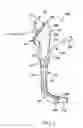 Fig. 03 - Intubation assistance apparatus
