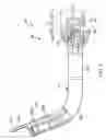Fig. 05 - INTUBATION ASSISTANCE APPARATUS