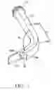Fig. 08 - INTUBATION ASSISTANCE APPARATUS