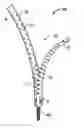 Fig. 01 - Minimally invasive retractor and methods of use