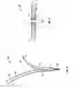Fig. 04 - Minimally invasive retractor and methods of use