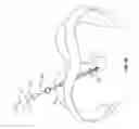 Fig. 20 - Minimally invasive retractor and methods of use