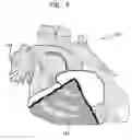 Fig. 08 - Synchronization of ultrasound imaging data with electrical mapping